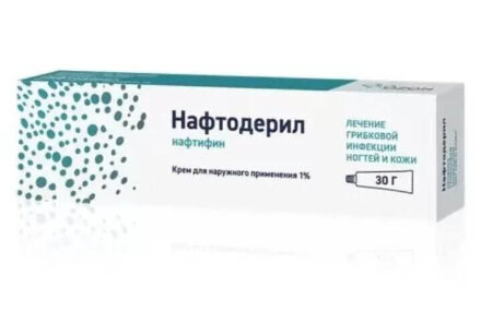 Naphthoderyl (Naftifine) cream 1%